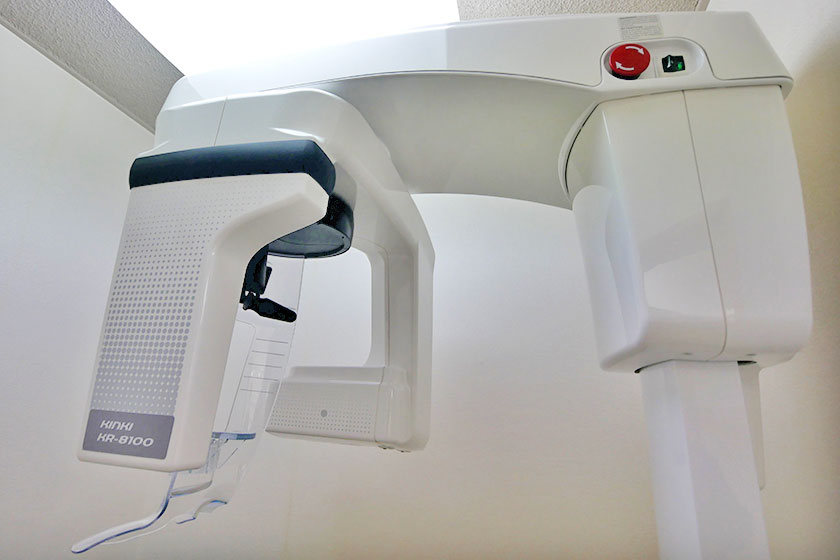 デジタルレントゲン